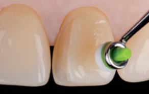 Ivoclar Optrasculpt Pad Kit & Refills