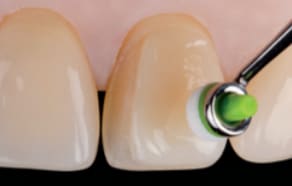 Ivoclar Optrasculpt Pad Kit & Refills
