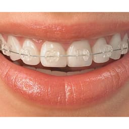 Osstem Orthodontics Perfect Clear 2 Saphire Mono Ceramic Bracket - 5