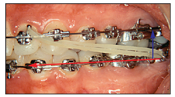 Wonder Colour Elastics 