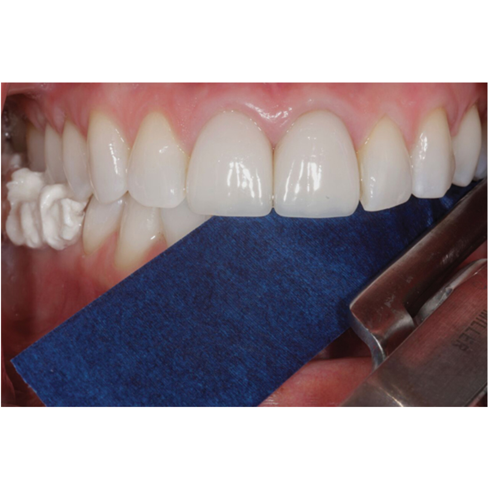 ET Dental Articulating Paper 