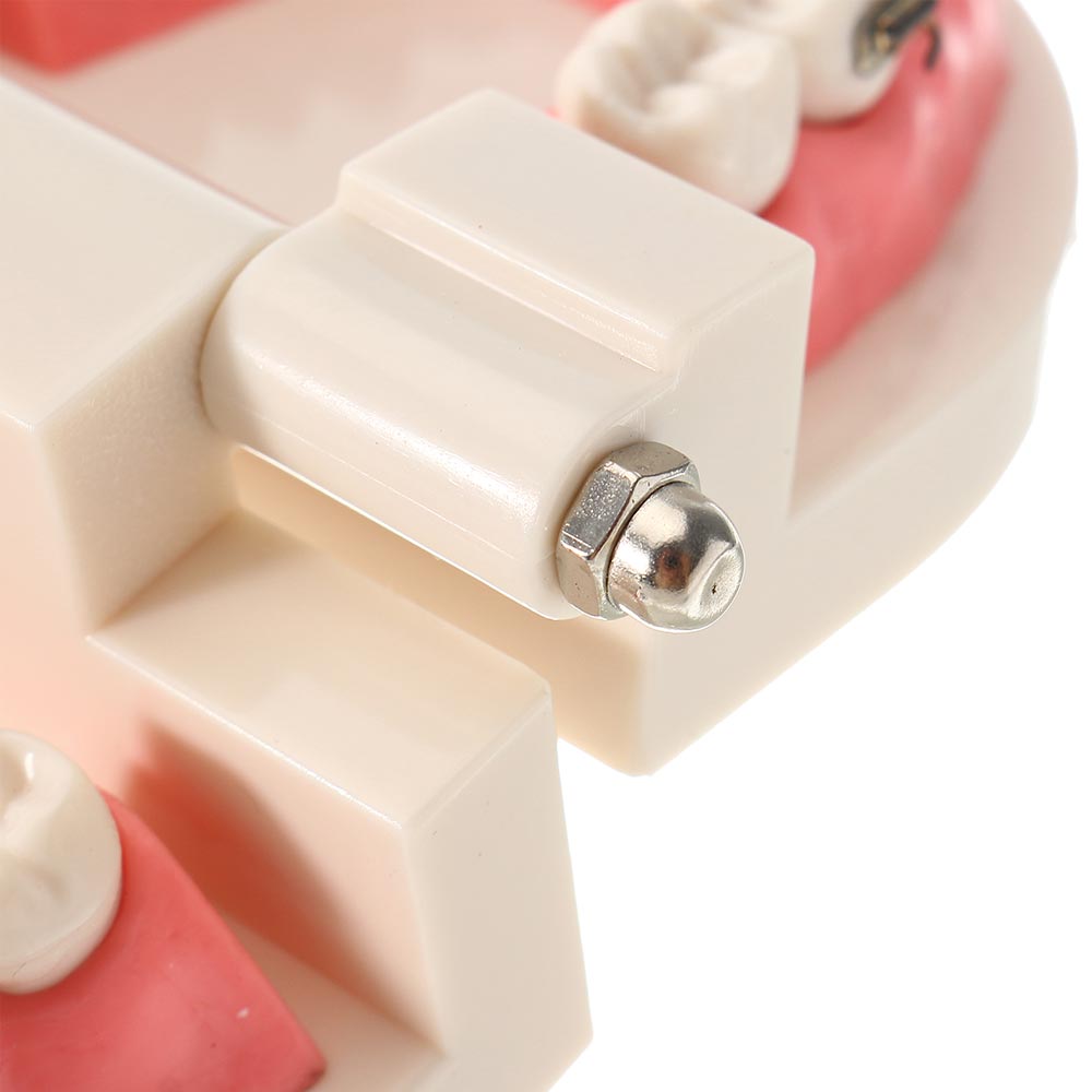 Patient Education Model With Orthodontic Brackets MD-119