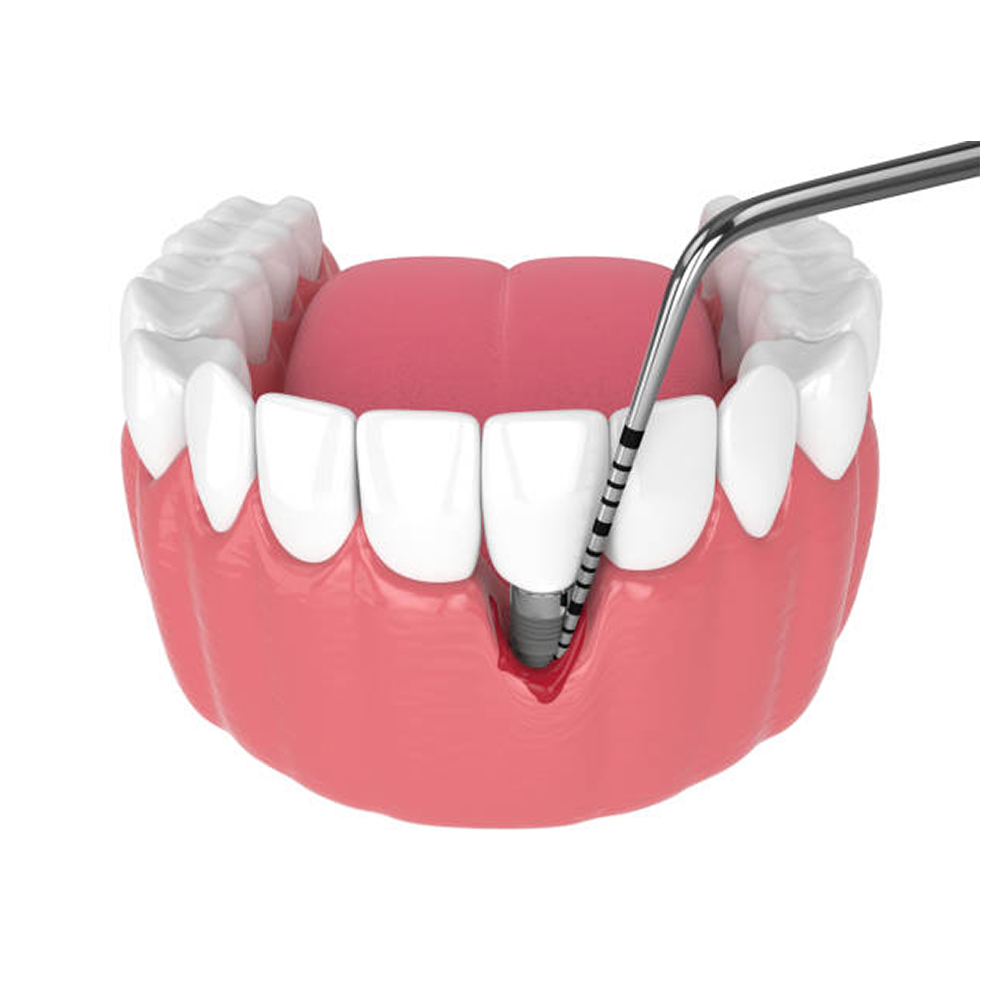 GDC Single End Probes University Of North Carolina #6 (Pcpunc15)