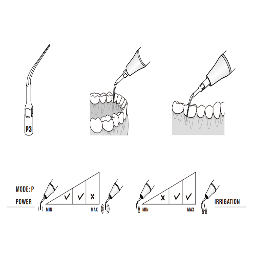 Woodpecker Scaler Tip P3 for UDS & EMS Scalers