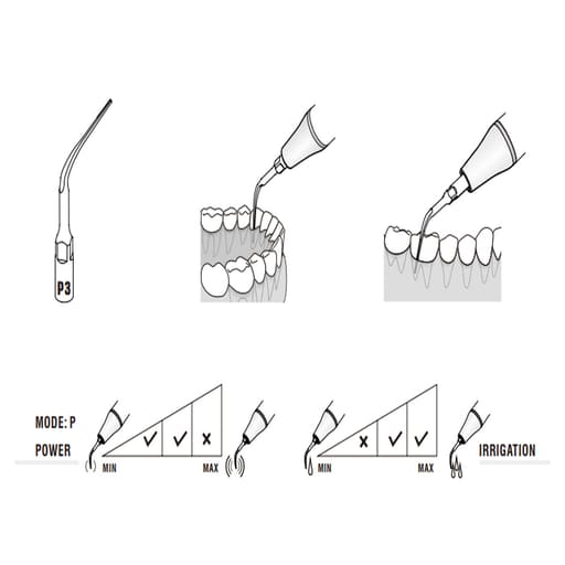 Woodpecker Scaler Tip P3 for UDS & EMS Scalers