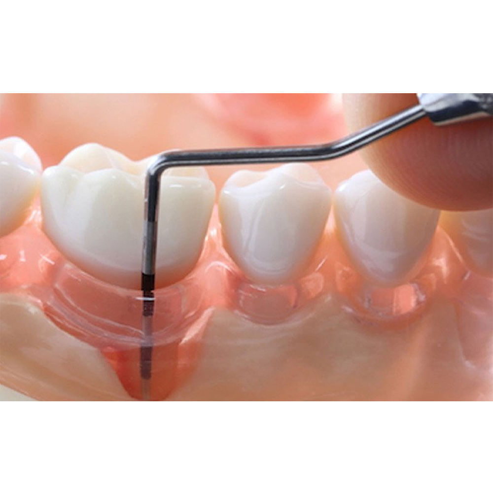 GDC Double End Probes Unc 15 / Screening Probe #6 (PCP15/11.5B)