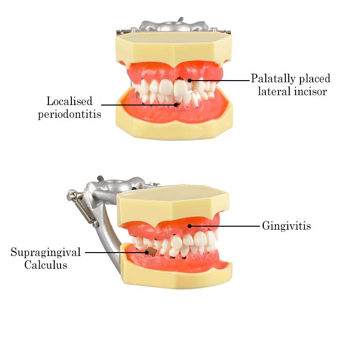 iDENTical Periodontal Model M4003