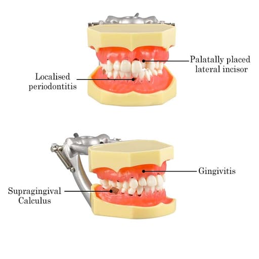 iDENTical Periodontal Model M4003