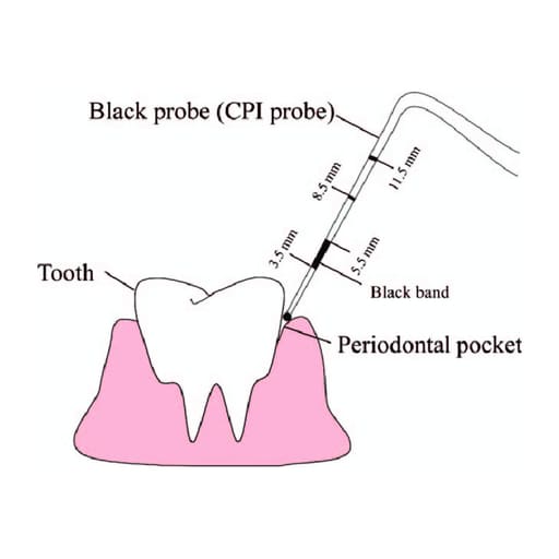 GDC Single End Probes Screening Probe (Who Probe) #6 (Pcp11.5b)