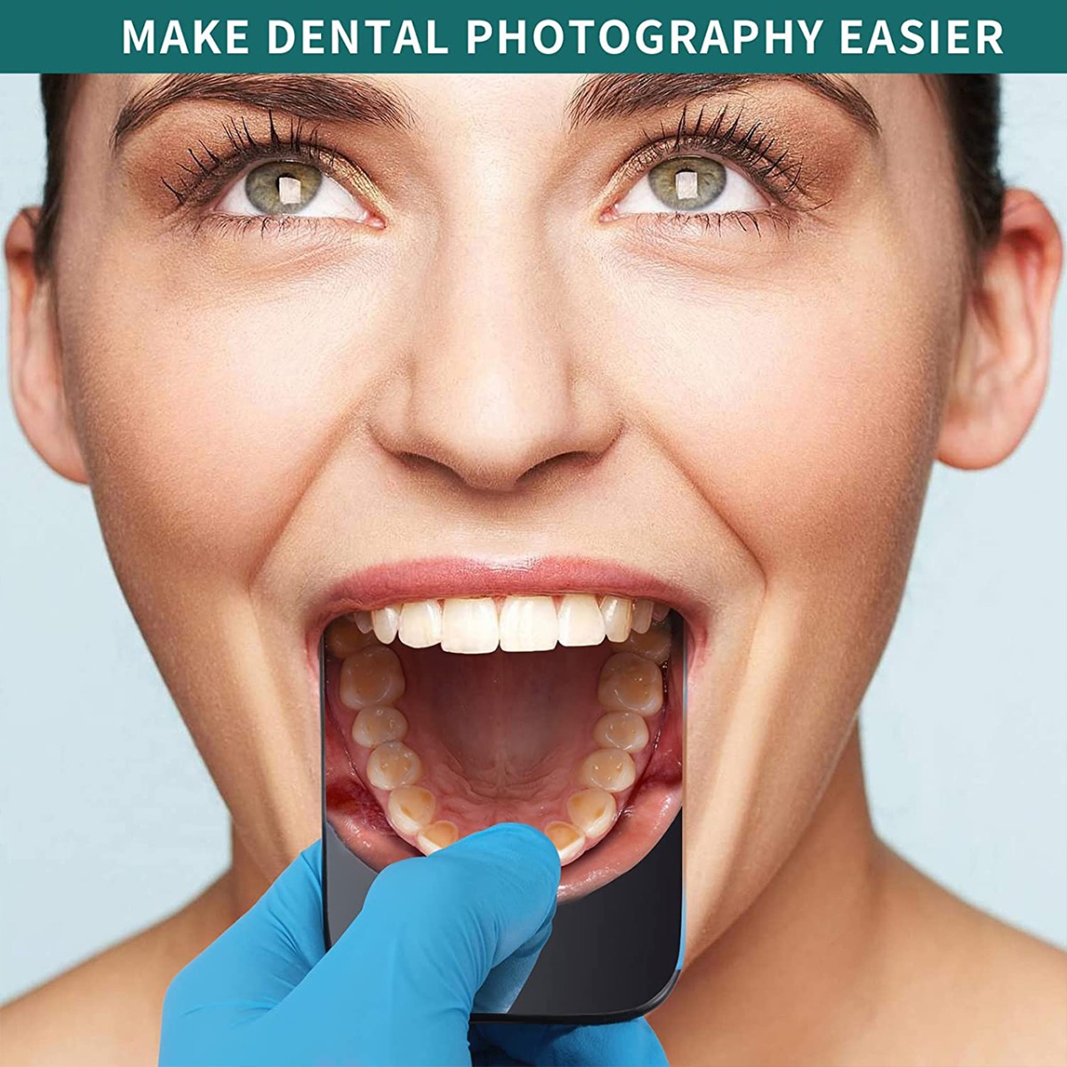 Waldent Photographic Mirror Stainless Steel Set of 6 (K30/2)