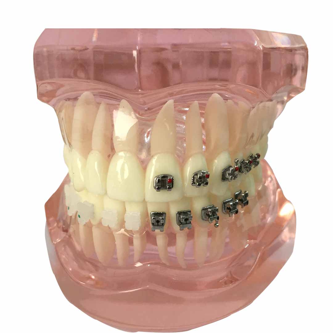 iDENTical Self Ligating Models M3012