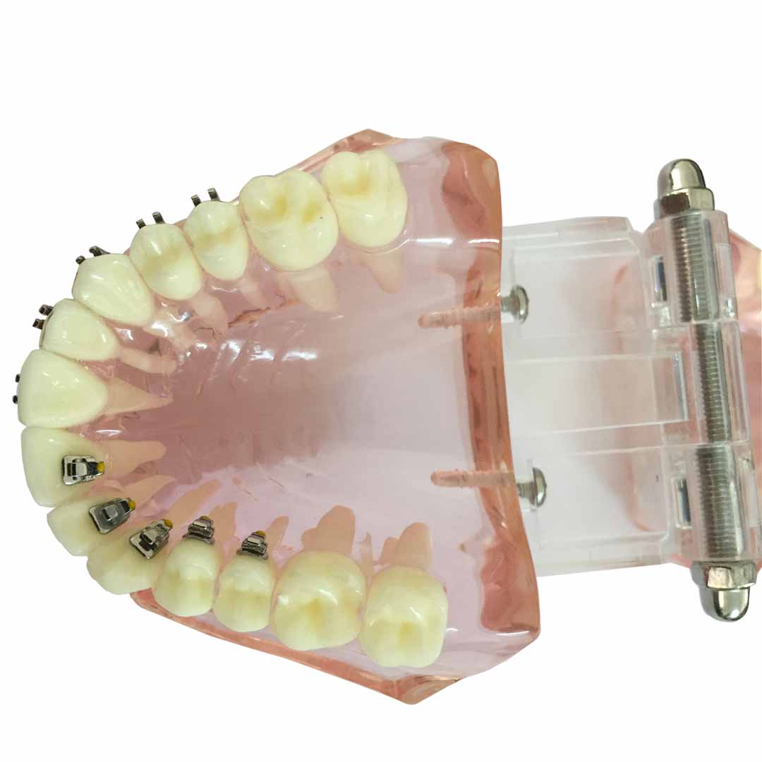 iDENTical Self Ligating Models M3012