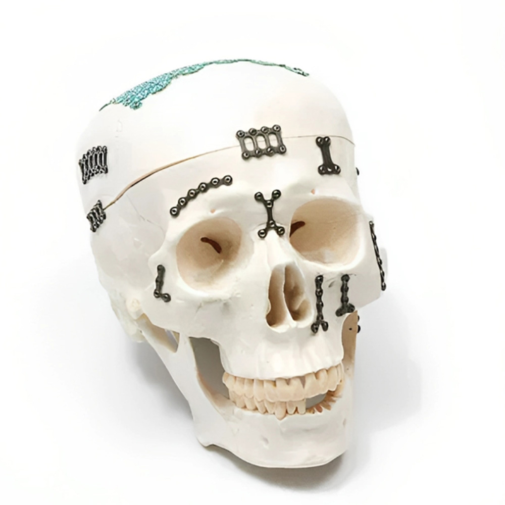 SK Surgicals SS Mini Bone 3D Plates - 2mm