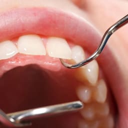 Dental