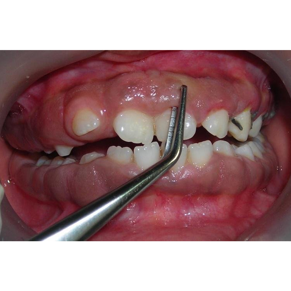 Waldent Pocket Marker Goldman Fox