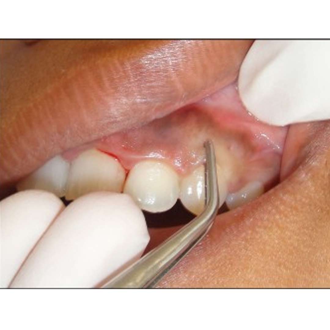 Waldent Periodontal Kit Set of 15 (K15/6)