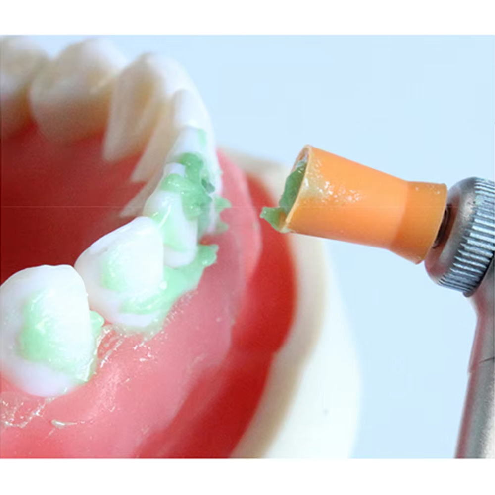 Vishal Dentocare VI ‐ Provil Prophylaxis Polishing Paste