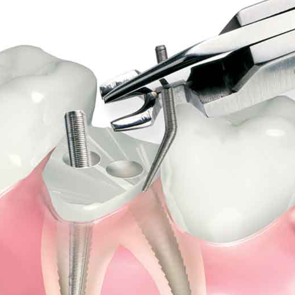 Filhol Dental Filpost Refill Packs