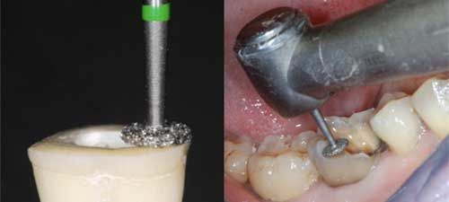 NewDiamond Wheel Round Diamond Bur -WR (Pack Of 3)