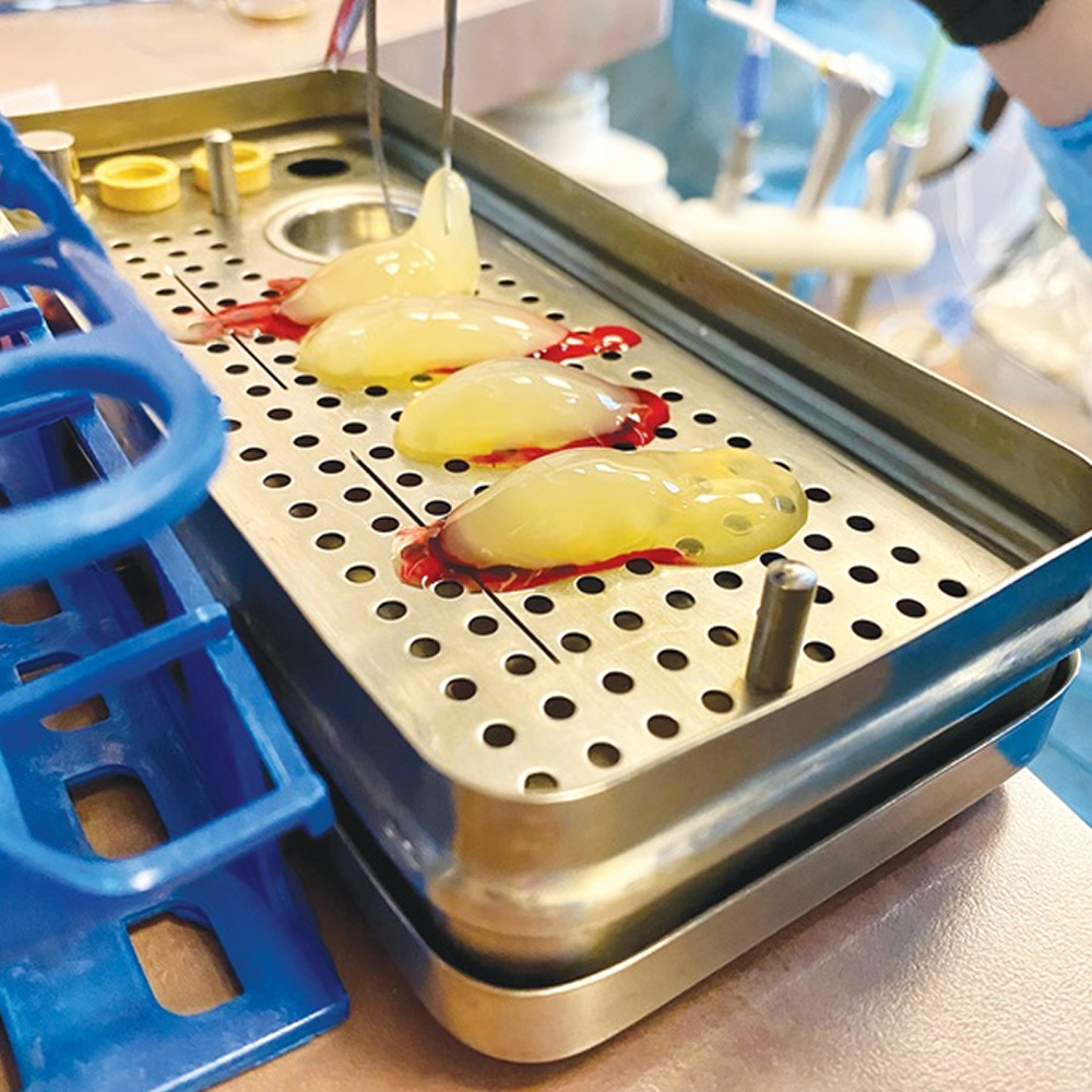 GDC Platelet Rich Fibrin Box - (PRF)