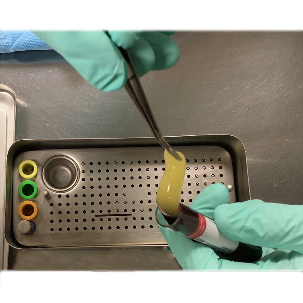 GDC Platelet Rich Fibrin Box - (PRF)