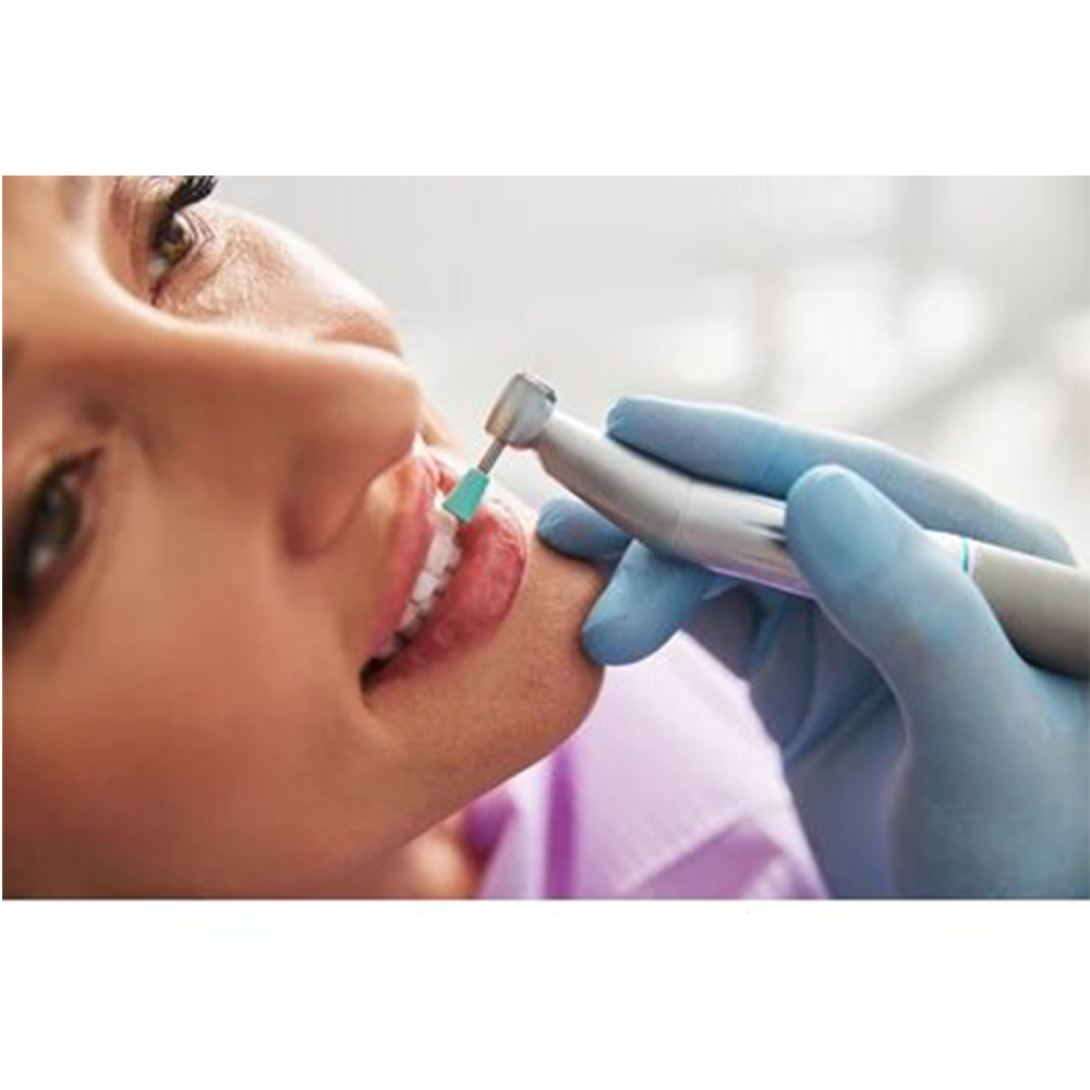 Cotisen Prophy Cups (Pack Of 100)