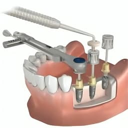 Nextin Dental Implant Prosthetic Hex Drivers - 3