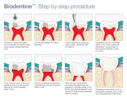 Septodont Biodentine Kit ( Pack of 5 capsules ) - 7