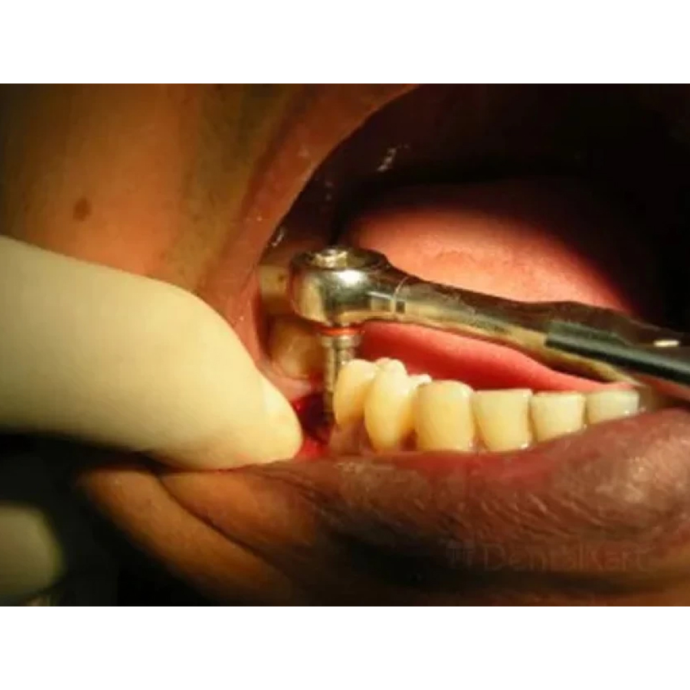 GDC Rachet Wrench Universal (RW)