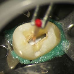 Prime Dental Rc Cal-I - 3