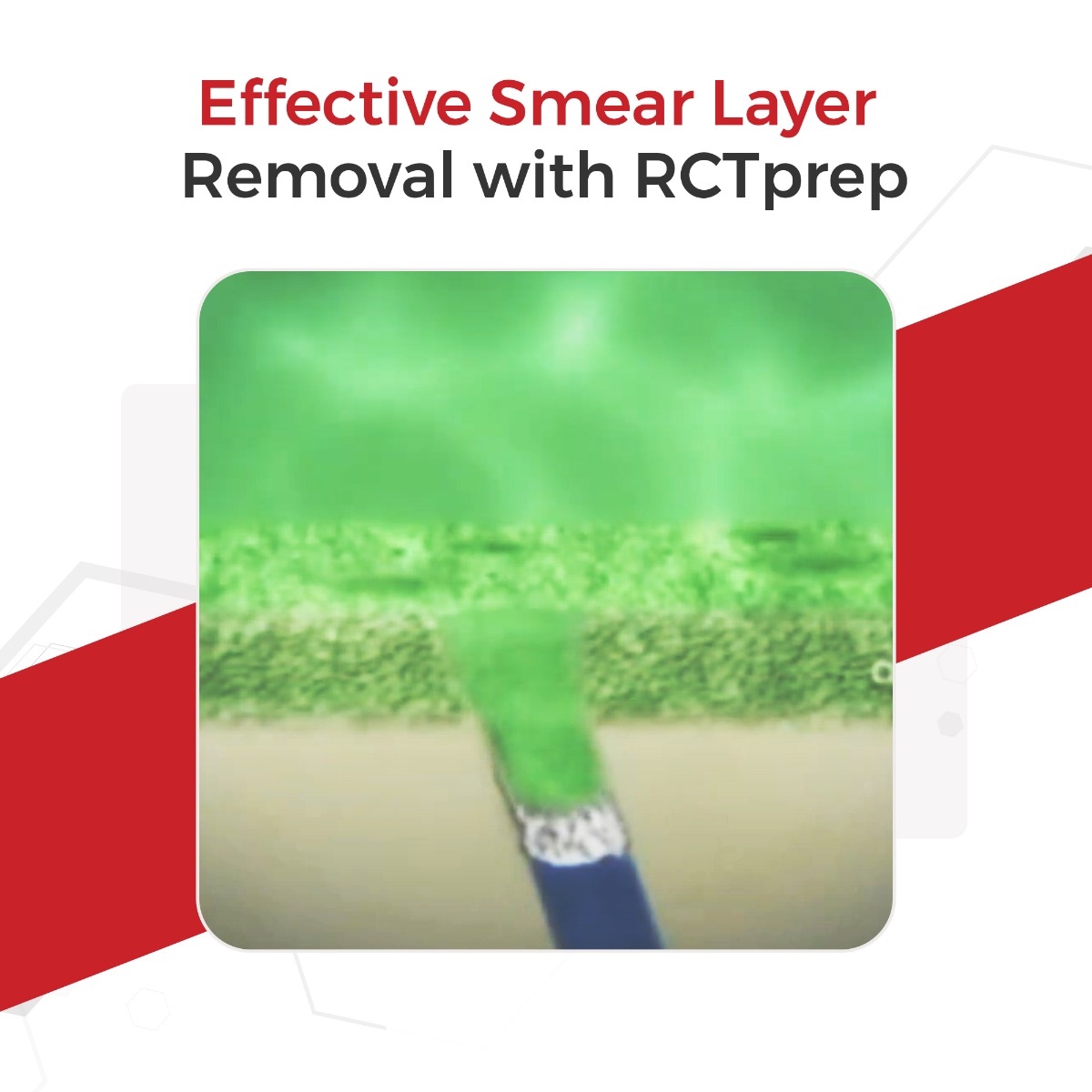 Waldent RCTprep EDTA