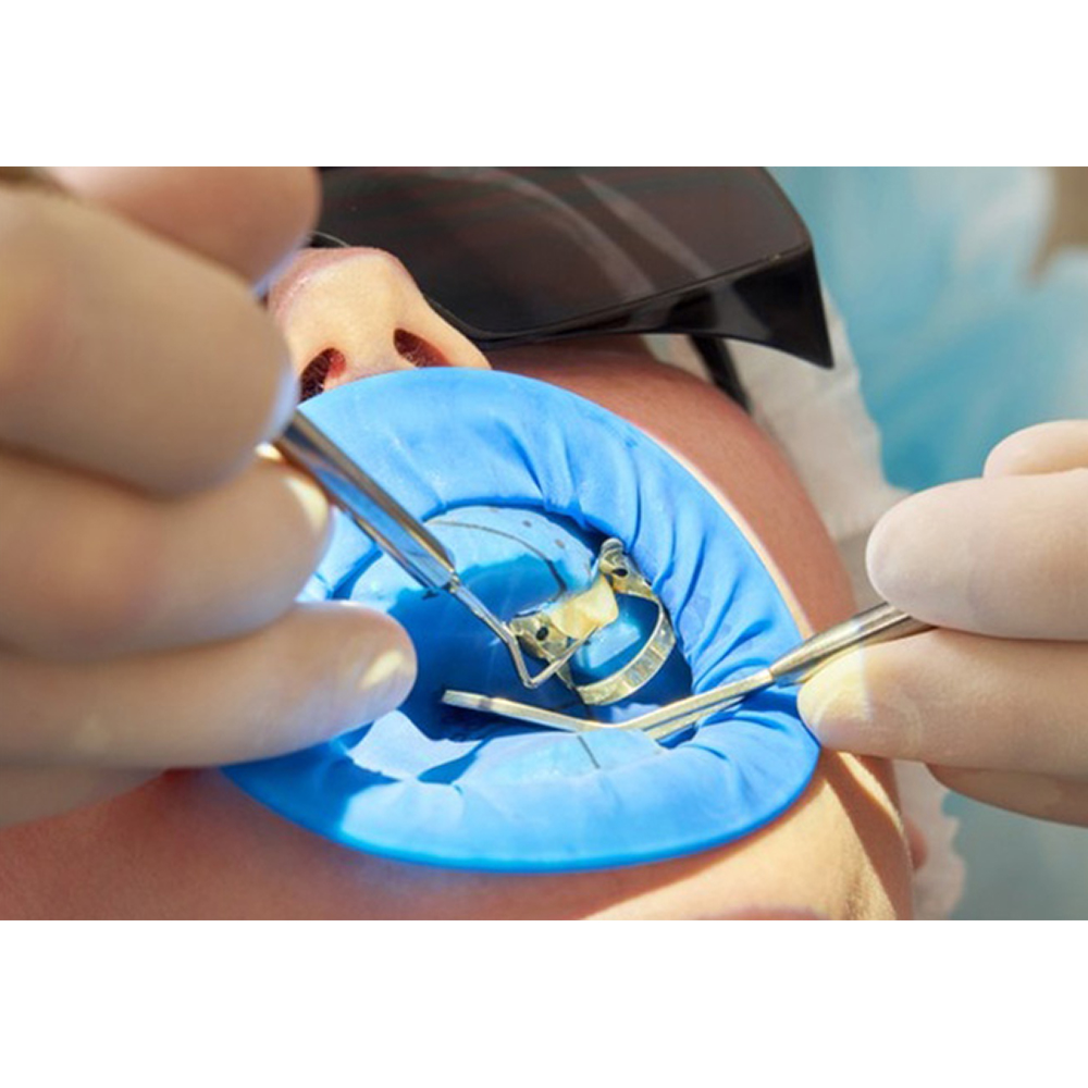 GDC Rubber Dam Clamps Set # Gold (RDCOBG11)