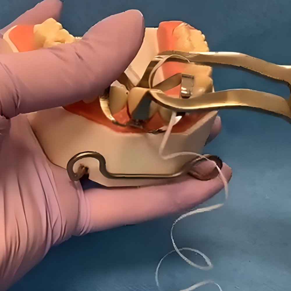 GDC Rubber Dam Forcep - Ivory (17cm) (Rdf)