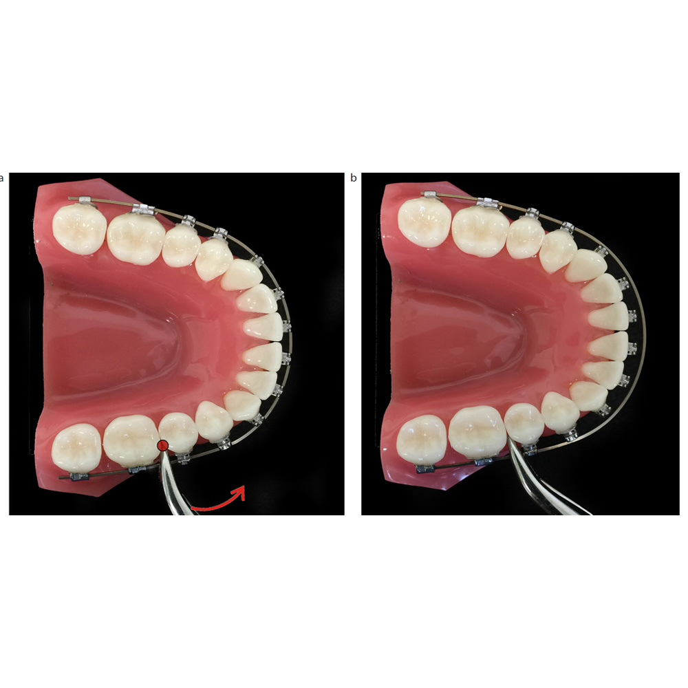 OrthoMetric SS Archwires - Rectangular (10/Pk)
