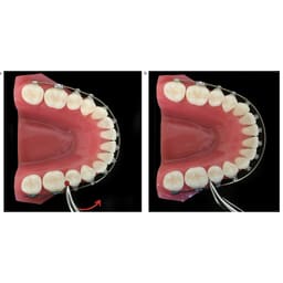 OrthoMetric SS Archwires - Rectangular (10/Pk) - 9