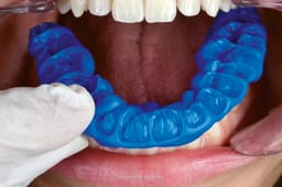 Waldent FlexiBite Bite Registration A-Silicone Impression Material - 10