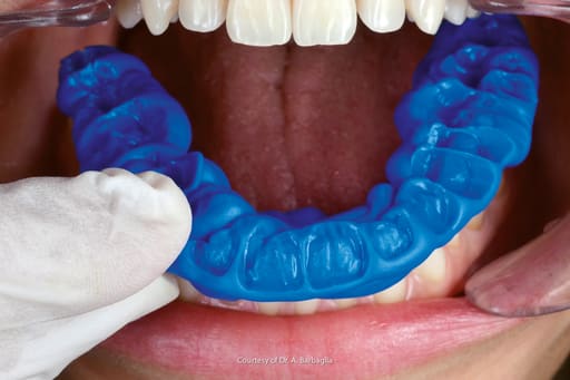 Waldent FlexiBite Bite Registration A-Silicone Impression Material