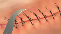 GDC Scissors Heath For Suture Cutting (15.5cm) (S25) - 7