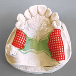 Maarc Retention Mesh (2952/010) - 5