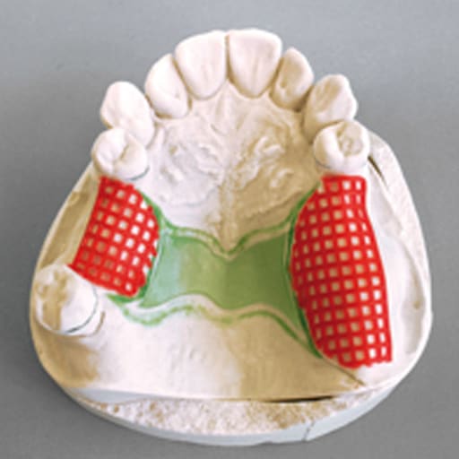 Maarc Retention Mesh (2952/010)