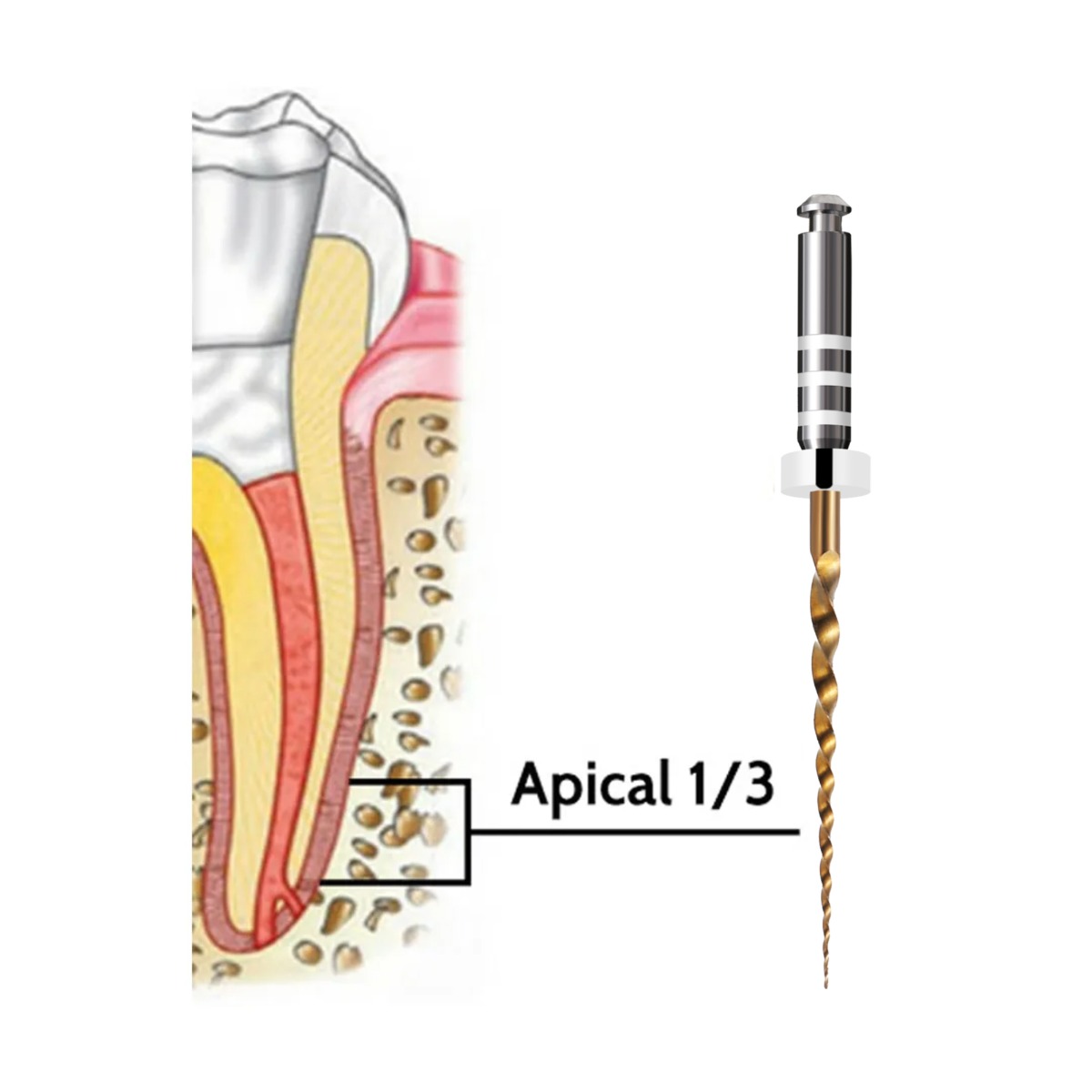Waldent Retreatment Rotary Files
