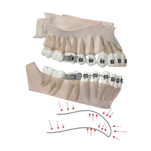 OSL NiTi Reverse Curve Archwires - Rectangular (Pack Of 10)