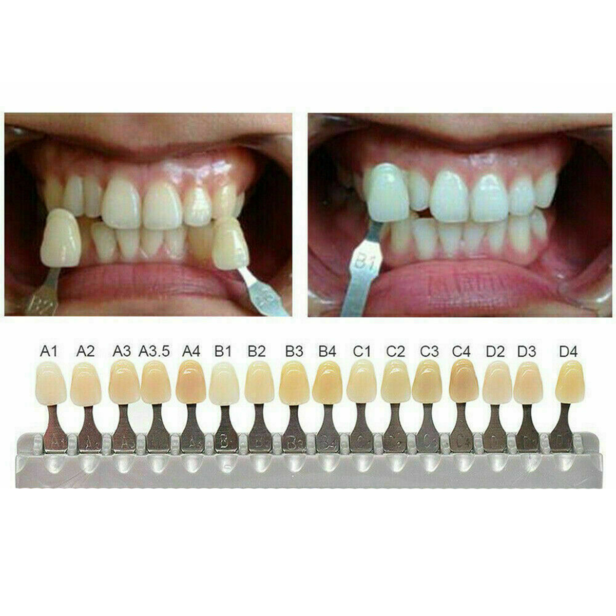 Vita Classical Shade Guide