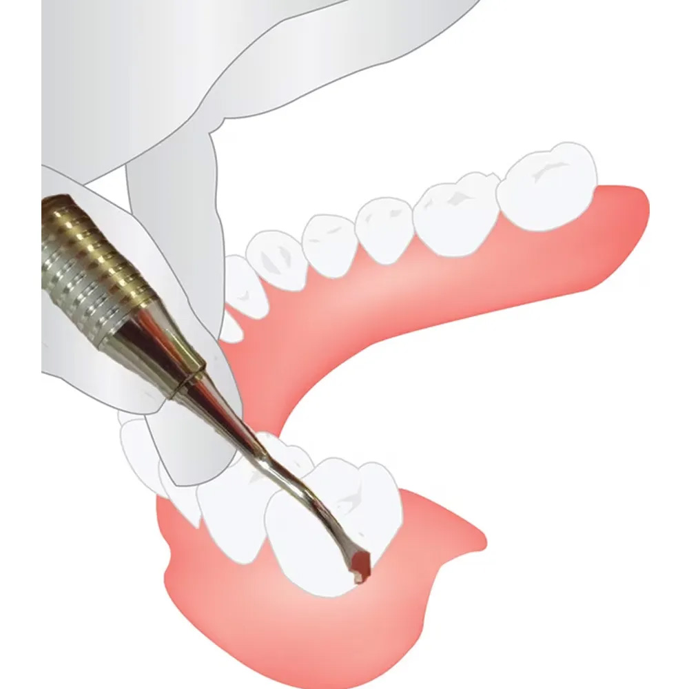 GDC Rhodes Back Action Chisel # 6 (C36/37)