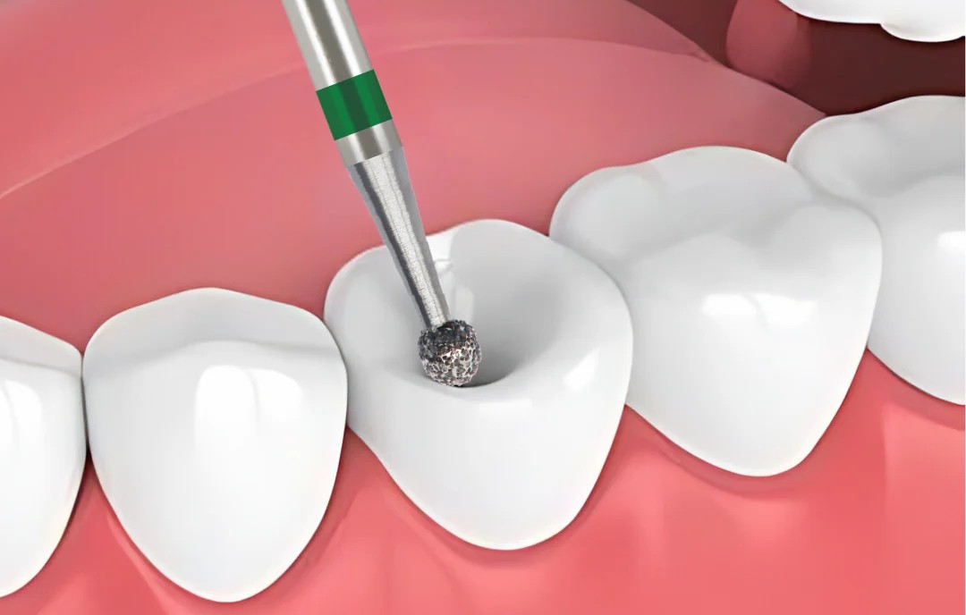 Frank Dental Round Diamond Burs BR Series (Coarse)