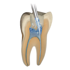 SafeEndo Smart Prep Liquid