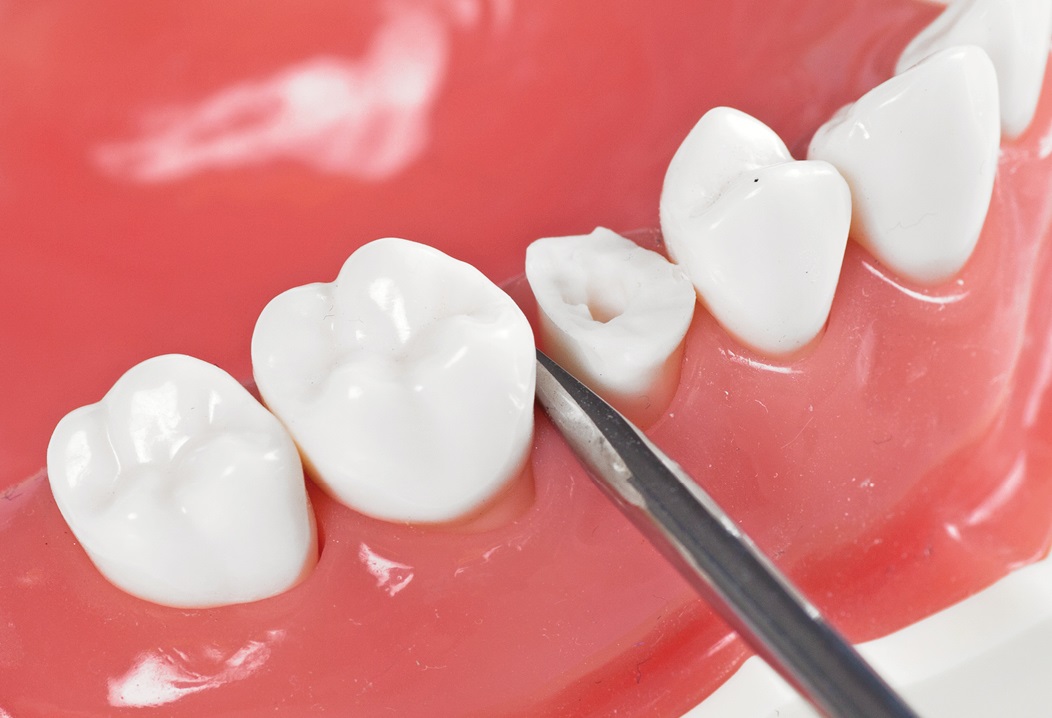 Waldent Root Elevators Premium Set of 11 (K2/2)