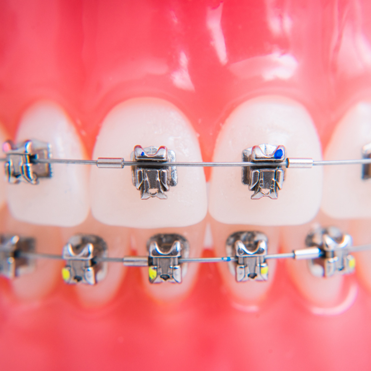 Orthodent Preformed Copper Niti SL Archwires Round With Stops (Pack of 10)