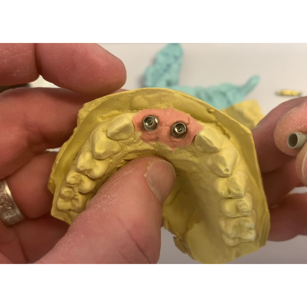 Adin RS Internal Hex Implant Analog (RS5737)