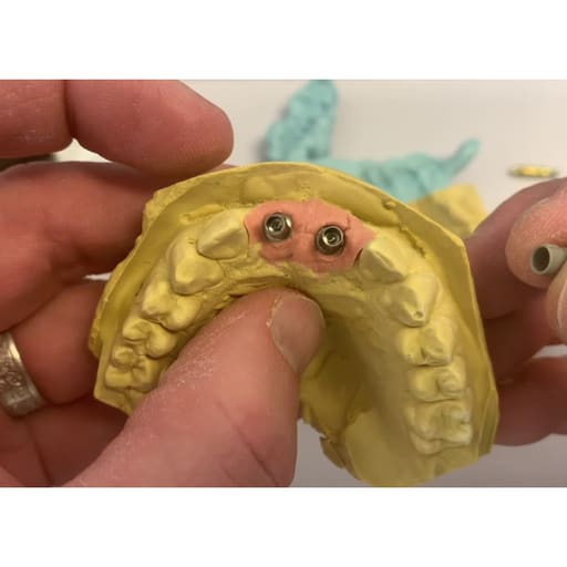 Adin RS Internal Hex Implant Analog (RS5737)